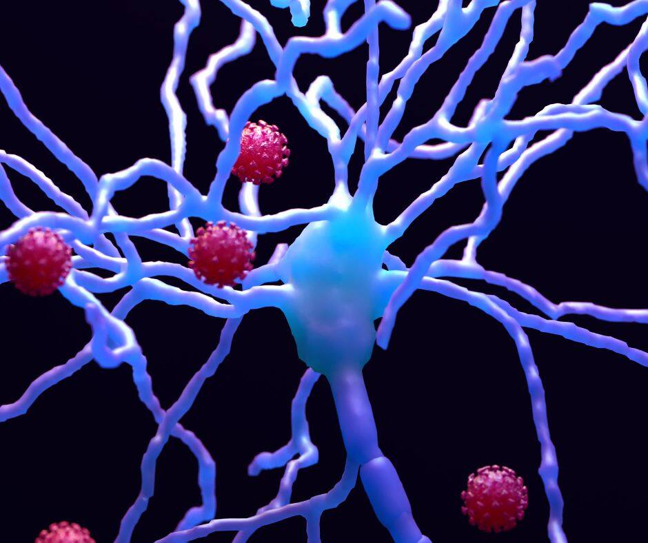Alzheimer y demencia